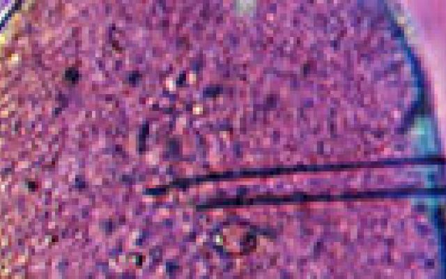 Artsen tegen Europese plannen voor virusscreening bij IVF