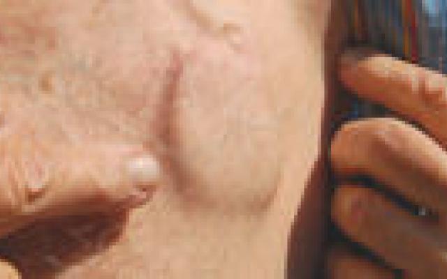 FDA-eisen cardiovasculaire apparaten niet zo strikt