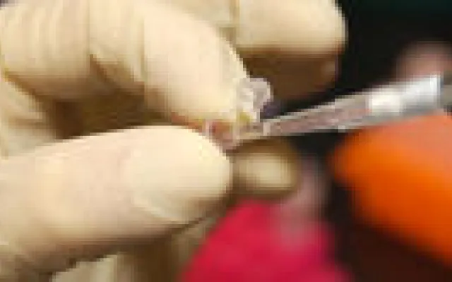 Twijfel over genetisch profiel cardiovasculair risico
