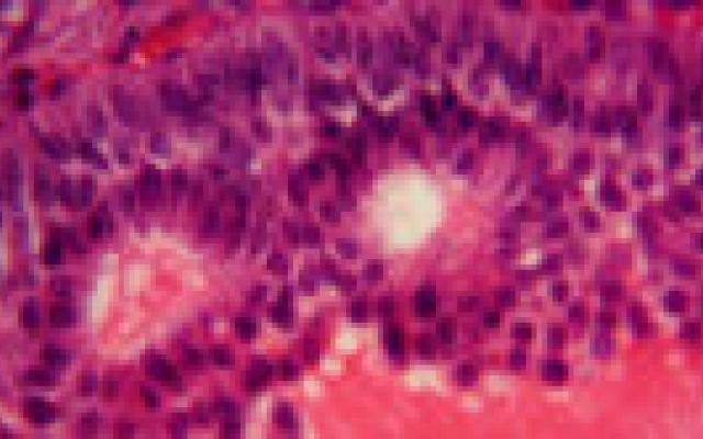 Eierstoktransplantatie: effectief op de lange termijn