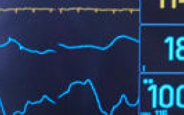 Druktemakers worden dikker