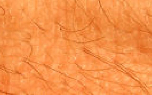 Stamcel herstelt wonden en vormt complete opperhuid