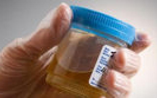 Urinekweek bij urineweginfectie nog steeds superieur