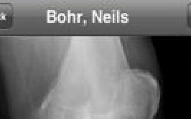 Radiologie: smartphone versus monitor