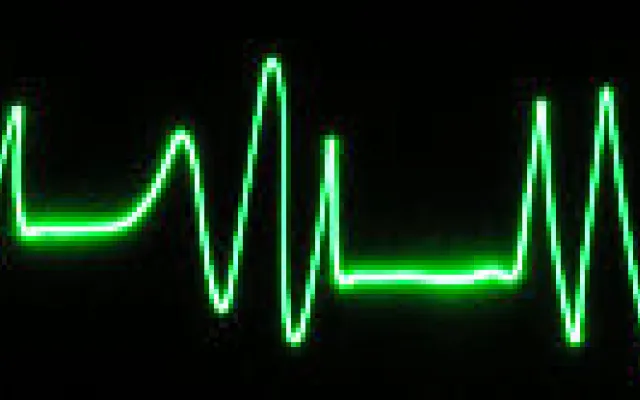 Strikte frequentiecontrole bij atriumfibrilleren onnodig