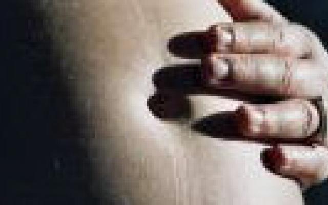 Late geboorte verhoogt risico op cerebrale parese