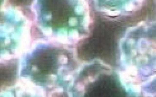 ‘Point-of-care’-tests chlamydia niet betrouwbaar