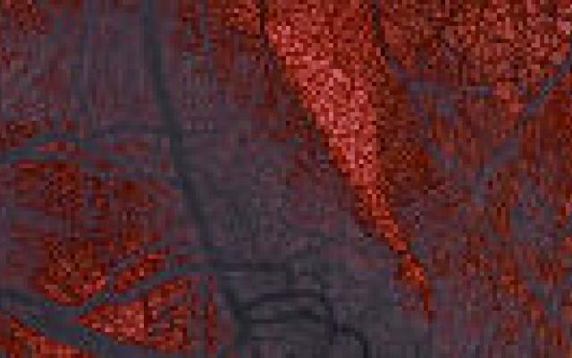 Beeldvorming asymptomatisch coronairlijden: tegenstrijdige richtlijnen