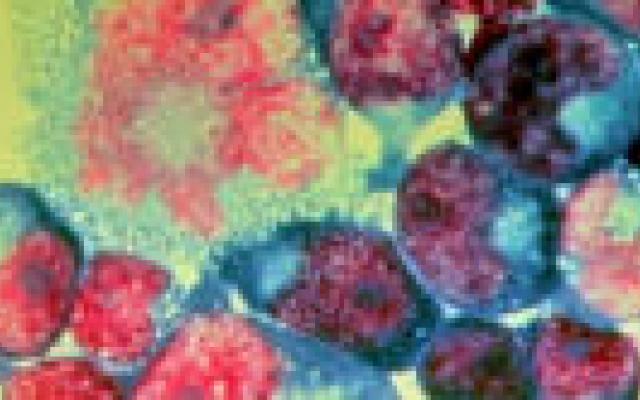 Falend regime bij kinderen met hiv