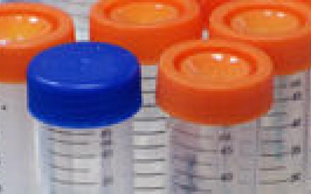 Schandaal schokt vertrouwen niet