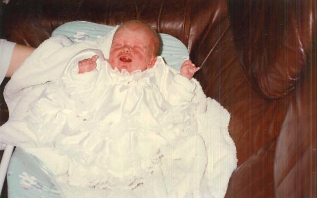 zuigeling met huidafwijkingen