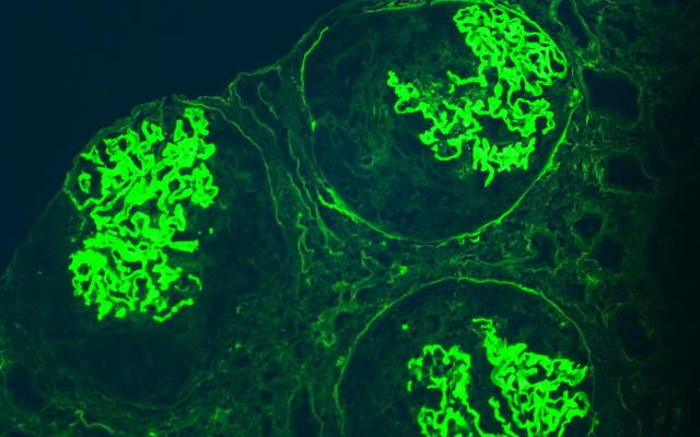 Drie glomeruli zichtbaar in immunofluorescentie-onderzoek.