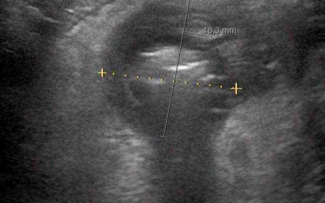 Week 3 D6328_F1bq.jpg