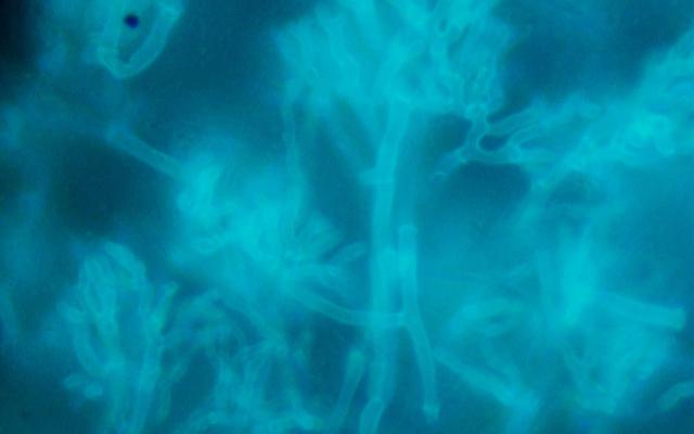 Microscopie van Aspergillus-draden.