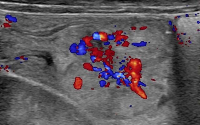Een echo van het abdomen.