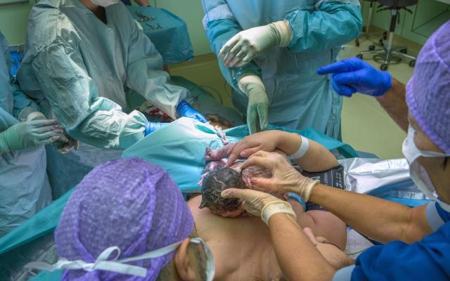 Een pasgeboren kind wordt op de borst van de moeder gelegd.