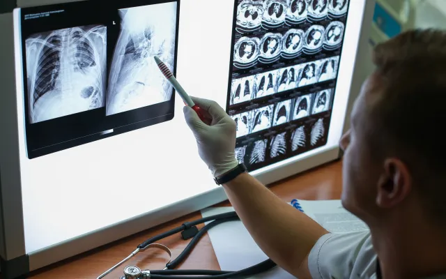 CT-scan