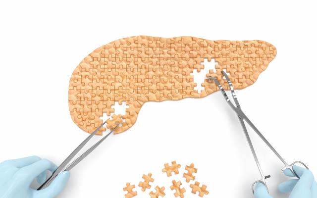 Een paar handen werkt aan een puzzel in de vorm van een pancreas.