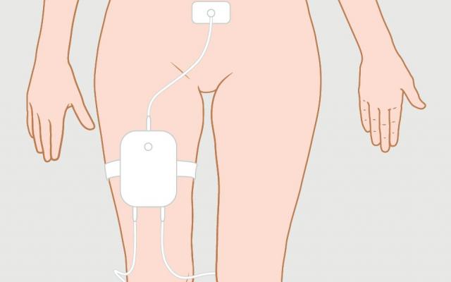 Lichaam met apparaatje op been en buik