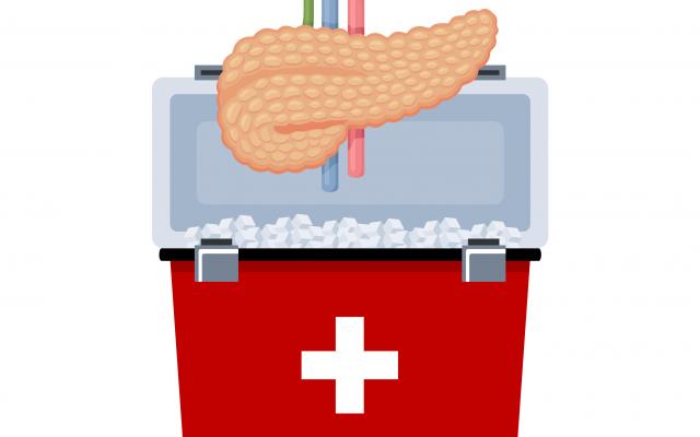 Tekening van pancreas in donorcoolbox