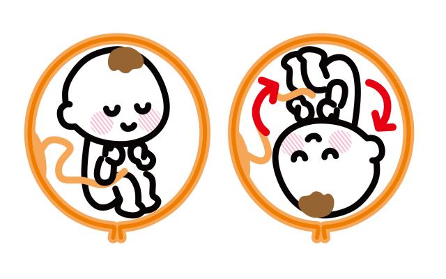 2 tekeningen van baby in baarmoeder; een met hoofd naar boven, een met hoofd naar beneden