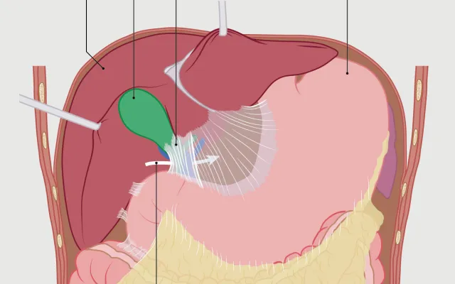 Ilustratie van maag, galblaas en lever