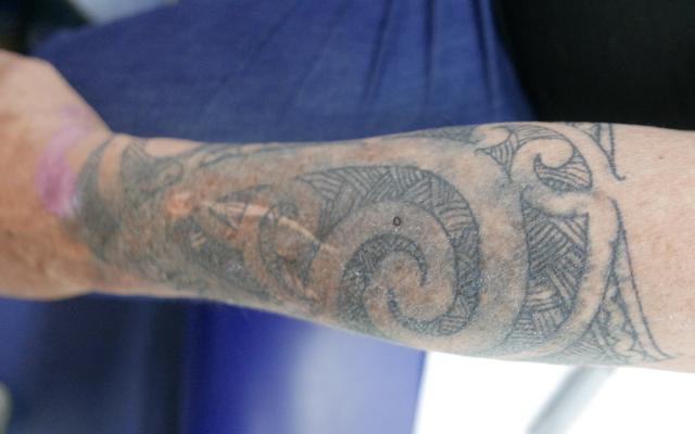 onderarm waarop een tatoeage te zien is die aan het verkleuren is.