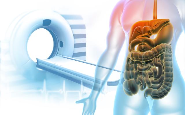 Illustratie van een scan apparaat samen met een lichaam waarin darmen te zien zijn