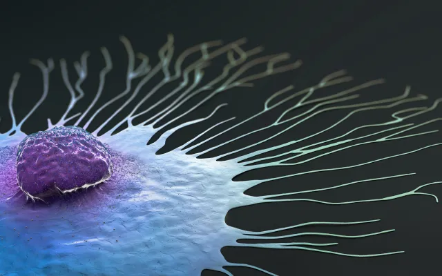 Foto: Christoph Burgstedt/iStock.com Microscopisch beeld van kanker