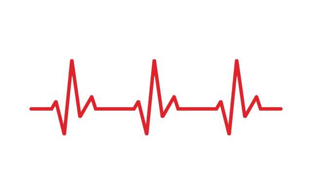 Illustratie van een cardiogram