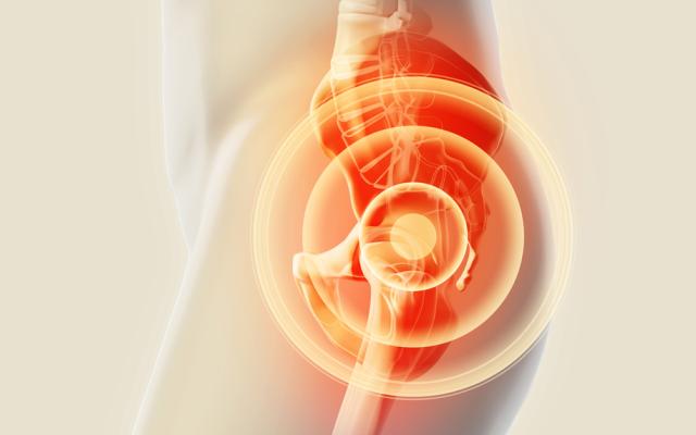 Skelet met pijn in de heup