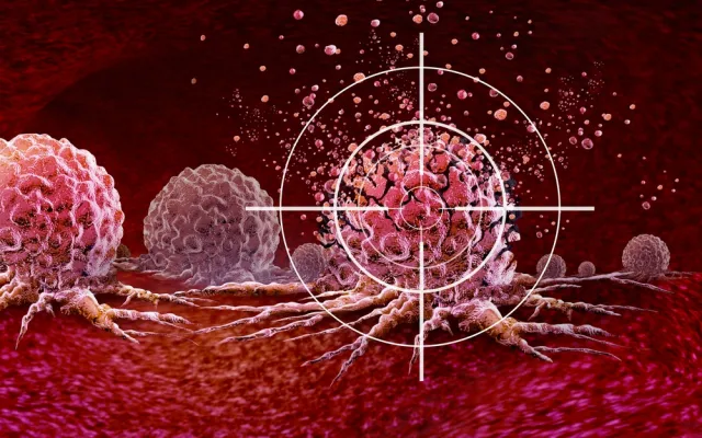 Tumor met een vizier erop gericht