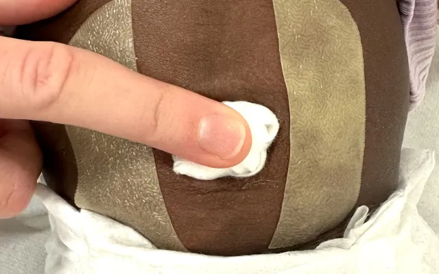 Beeld uit artikel Een afgeplakte navel van baby