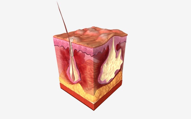 Dwarsdoorsnede van de huid