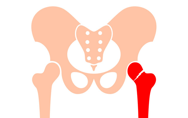 Illustratie van een heup