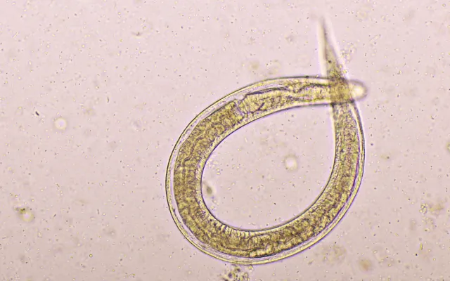 Beeld: Jarun Ontakrai/Shutterstock Strongyloides stercoralis