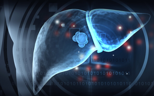 Illustratie van een lever met een tumor
