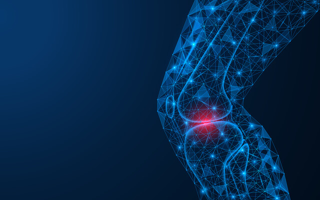 Een knie met artrose