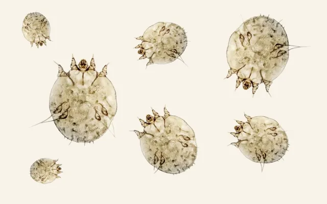 Scabies