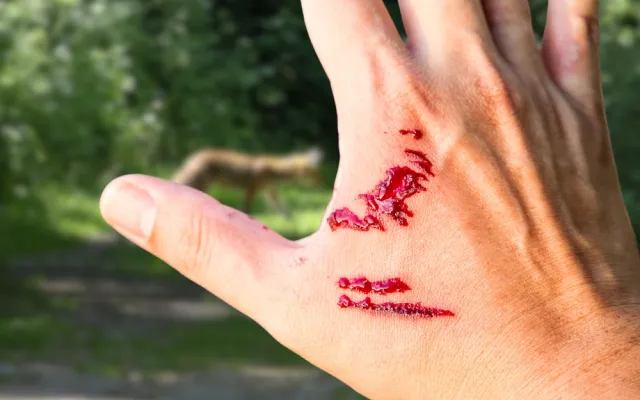 Een hand met wonden
