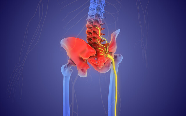 Illustratie van het sacro-illiacale gedeelte van de rug