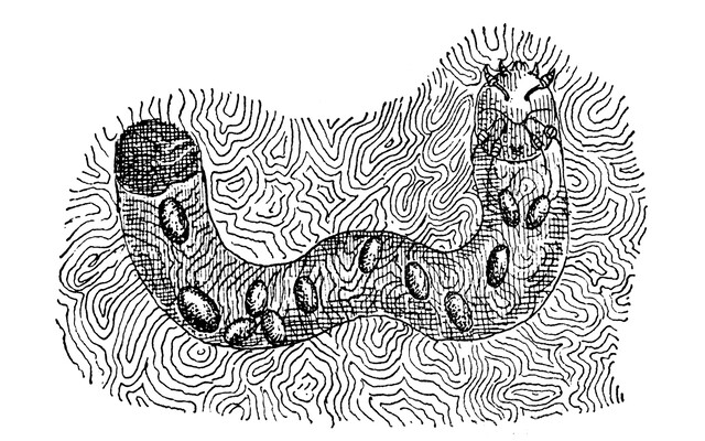 Illustratie van een scabies