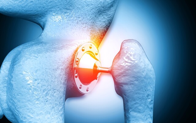 Illustratie van het kogelgewricht van de schouder