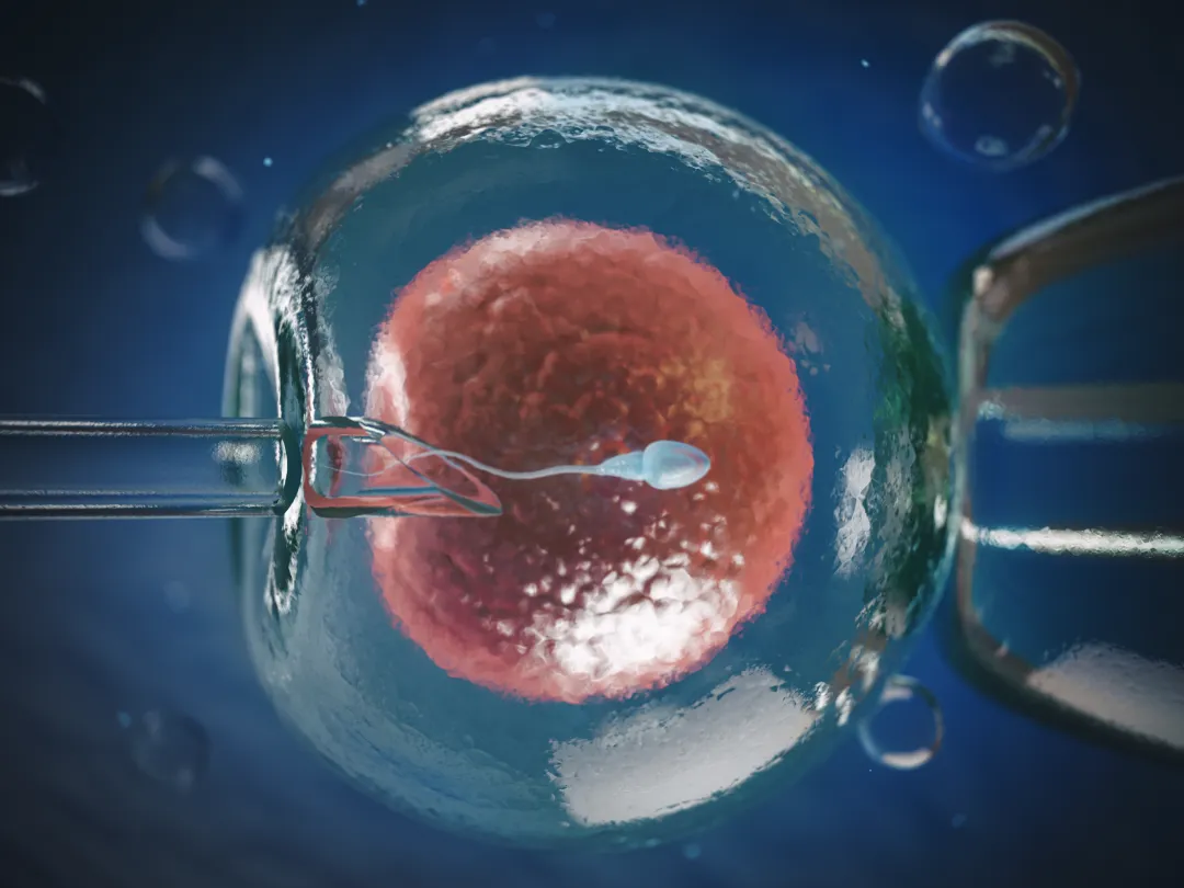 IVF-behandeling.