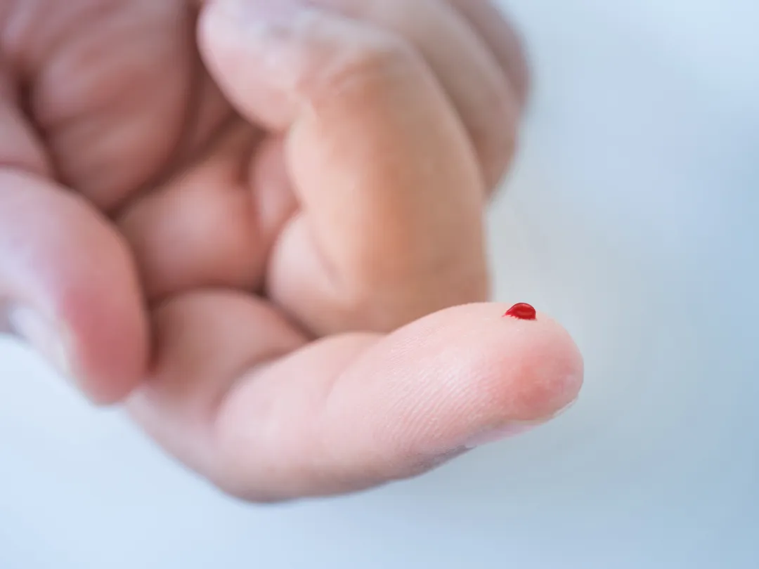 Een vinger met een druppel bloed.
