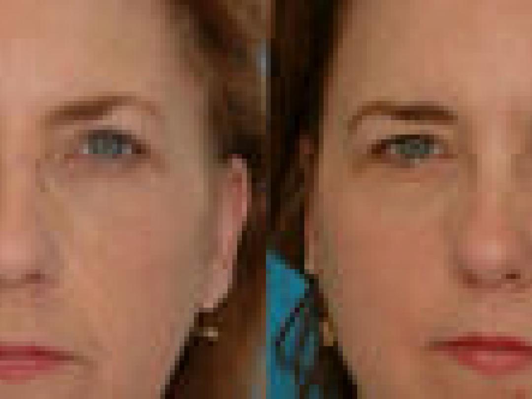 Gezonde leefstijl voorkomt plastische chirurgie