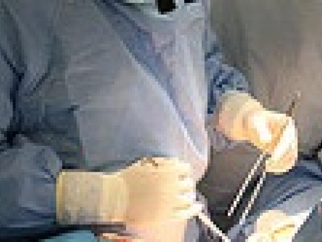 Seroom na borstkankeroperatie spreekt niet vanzelf