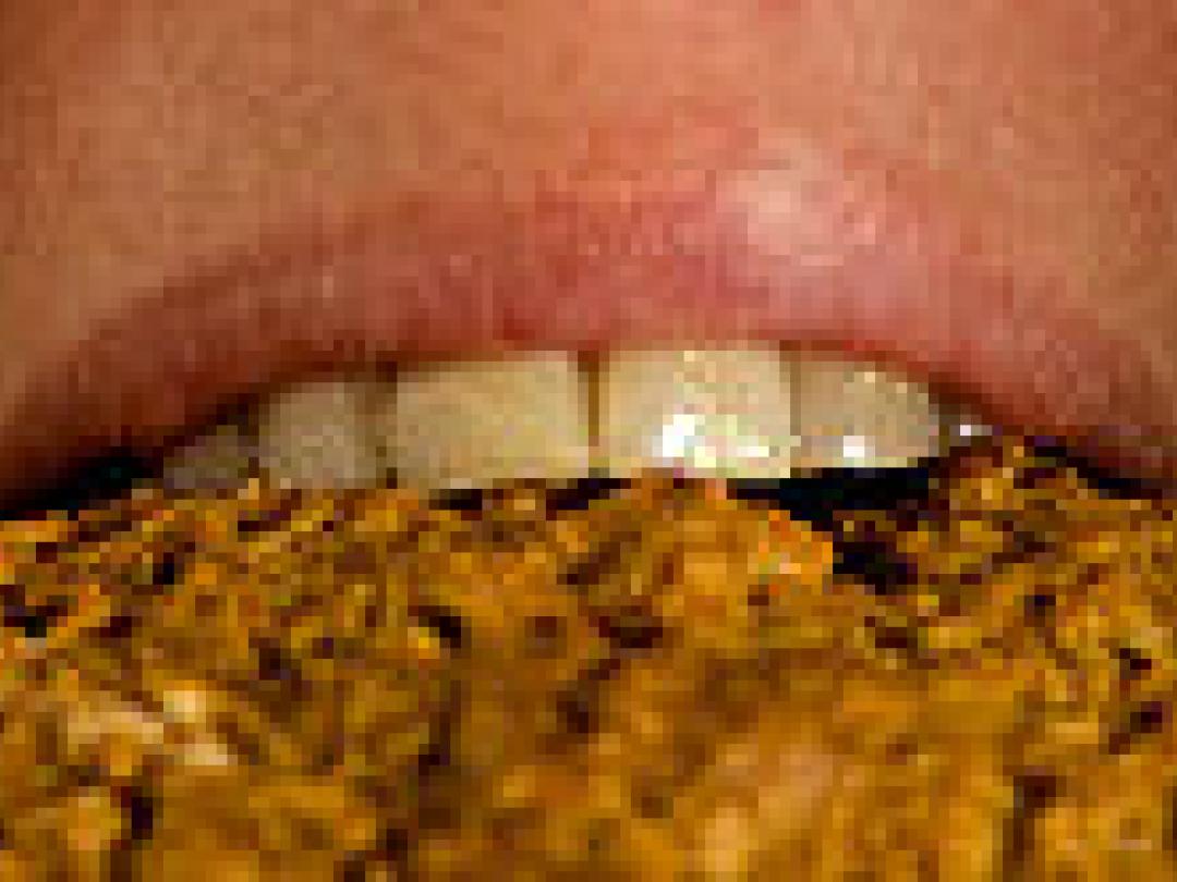 Geen bewijs voor vezeldieet bij diverticulose