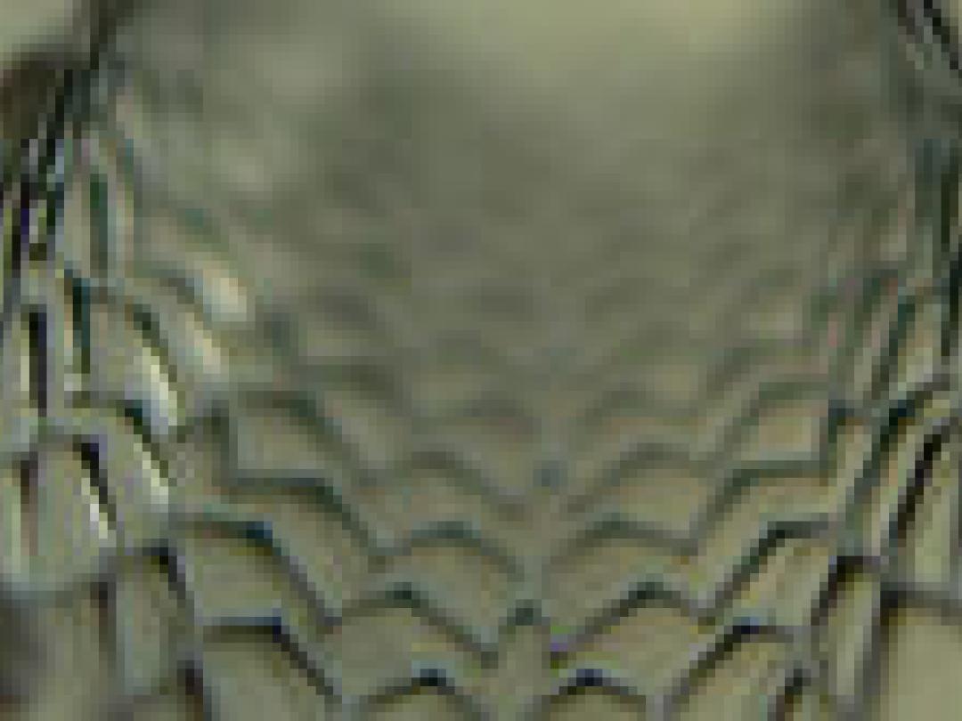 Risico van ondanks stent groeiend aneurysma lijkt mee te vallen