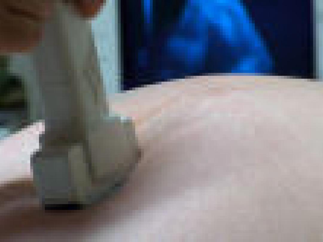 Ligging van kind op echo niet voorspellend voor bevalling